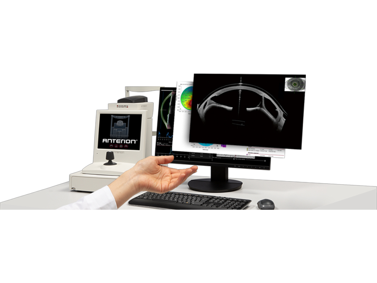Anterion Multimodal Imaging Platform