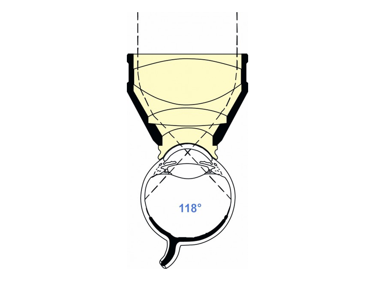 Lentille grand champ de Mainster - 1 pc