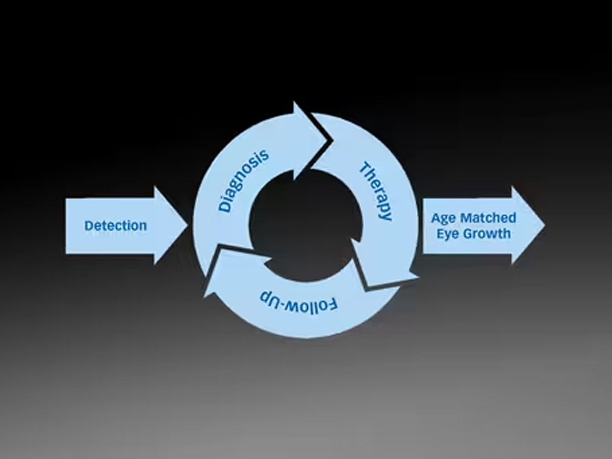 Lenstar Myopia APS Optische biometer