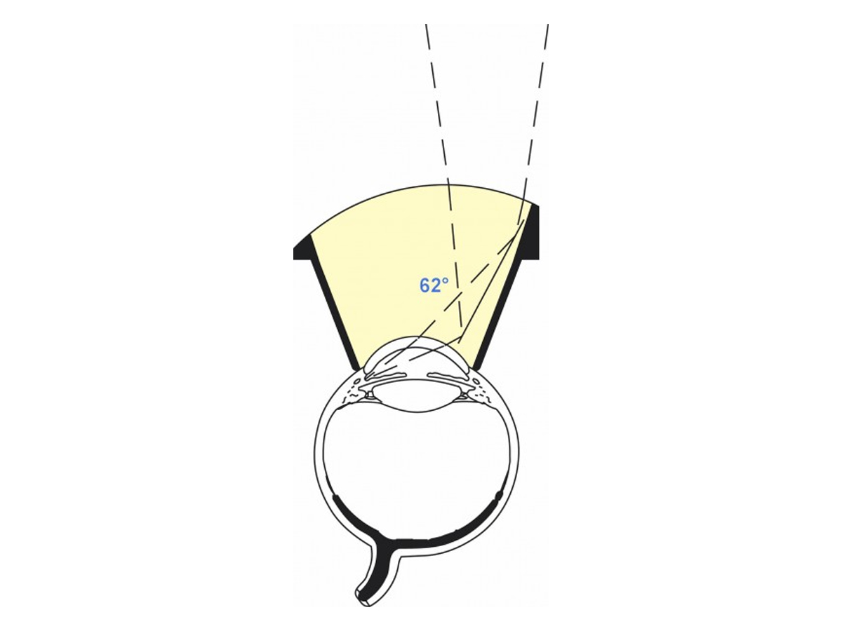 Lentille Magna View Gonio - 1 pc