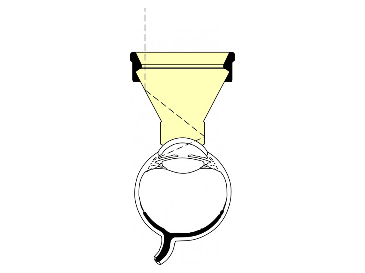 Khaw 4D Direct View lentille Gonio - 10 mm - 1 pc