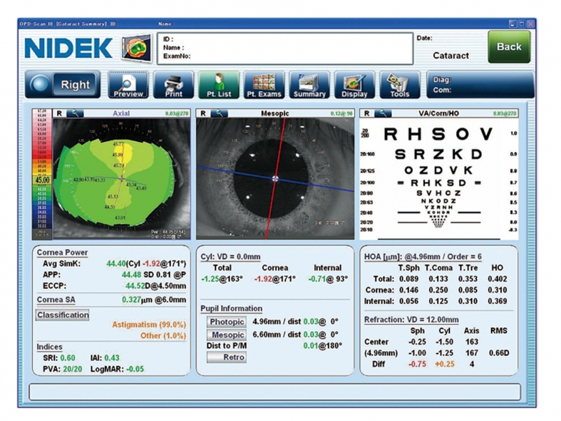 OPD-Scan III Analyseur de puissance réfractive et de cornée