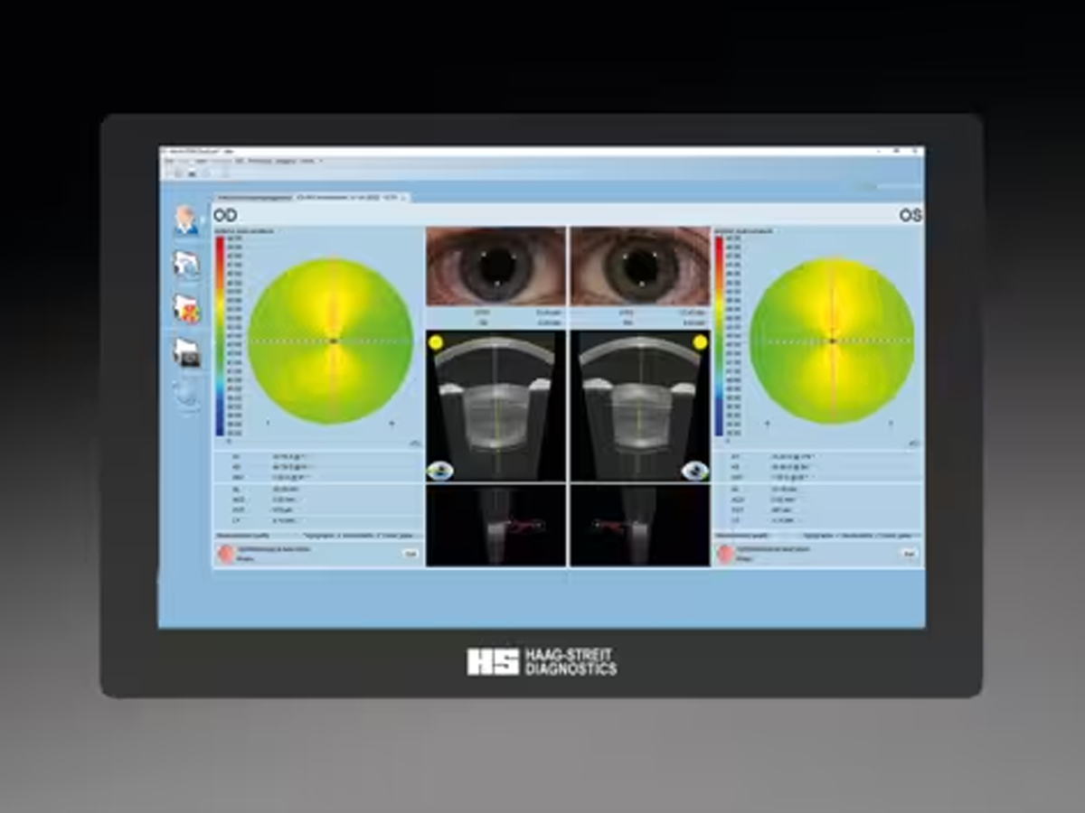 Eyestar 900 inclusief Cataract Suite