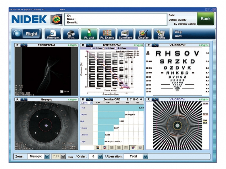 OPD-Scan III Analyseur de puissance réfractive et de cornée
