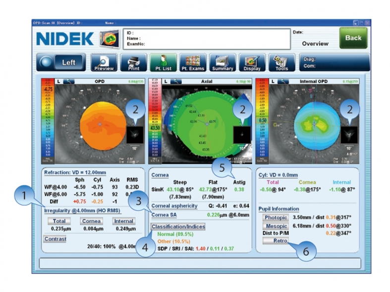 OPD-Scan III Analyseur de puissance réfractive et de cornée