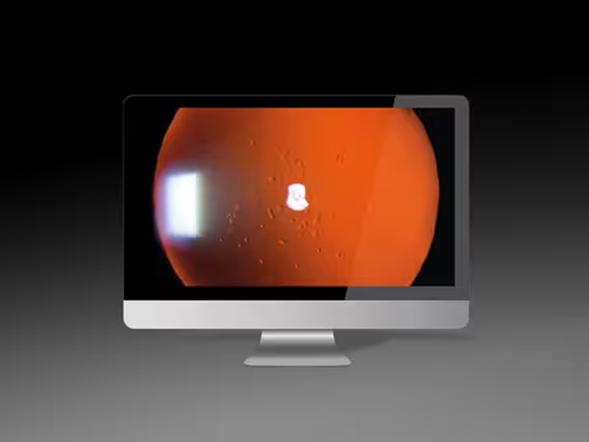 Imaging module 910