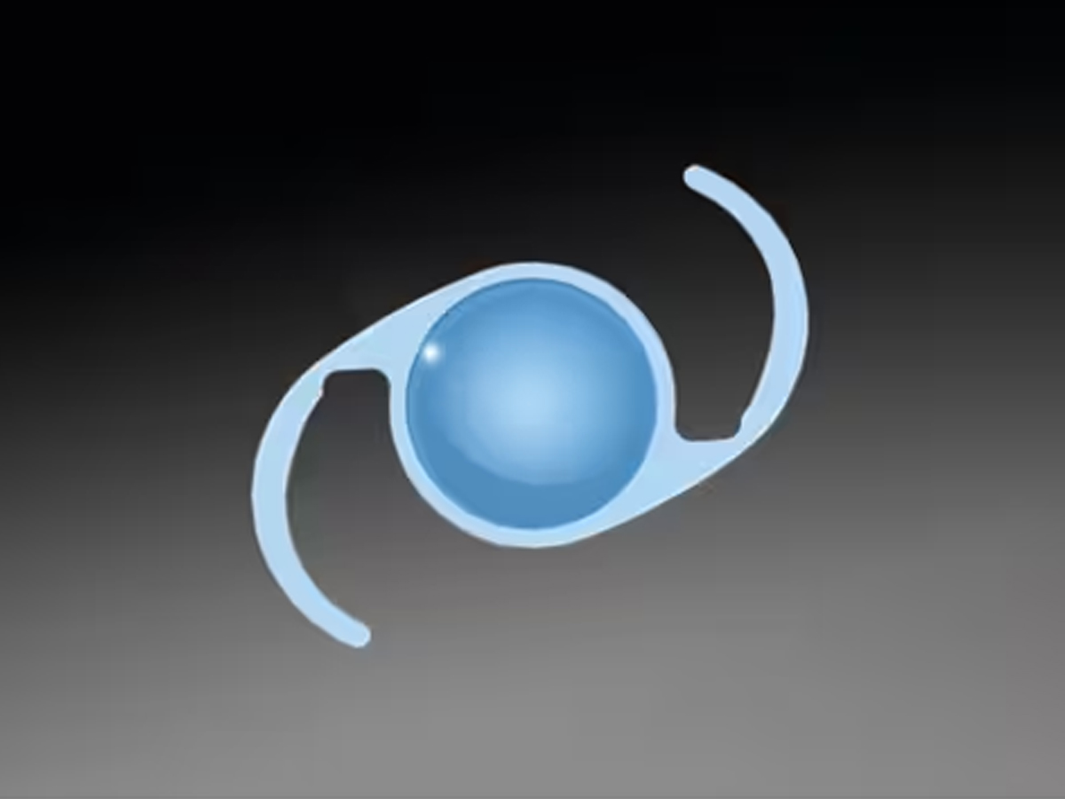 Eyestar 900 inclusief Cataract Suite