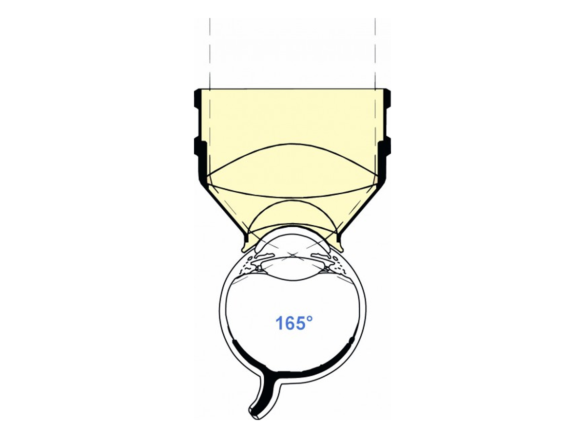 Mainster PRP 165 lentille - laser - 1 pc