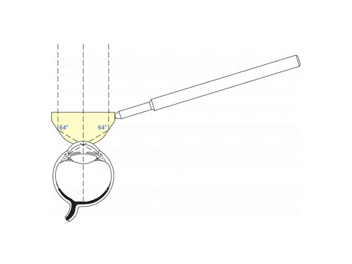 Gonioprisme de Posner avec poignée ronde - Noir - 1 pc